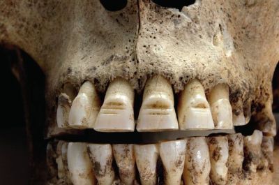 Filed vikings teeth