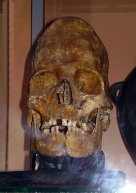Et typisk kulturelt betinget deformeret kranie - Stavropol Museum