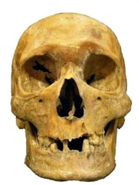 Sweyn Estridson's skull