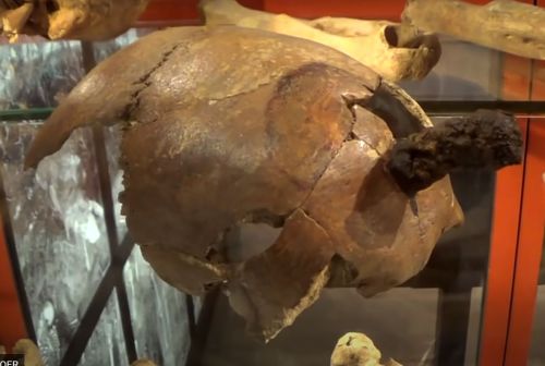 Skull of peasant warrior from Gotland